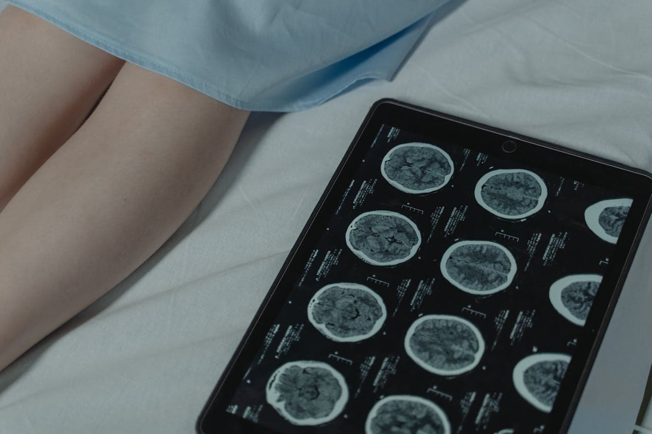 Brain Tumor Surgery
