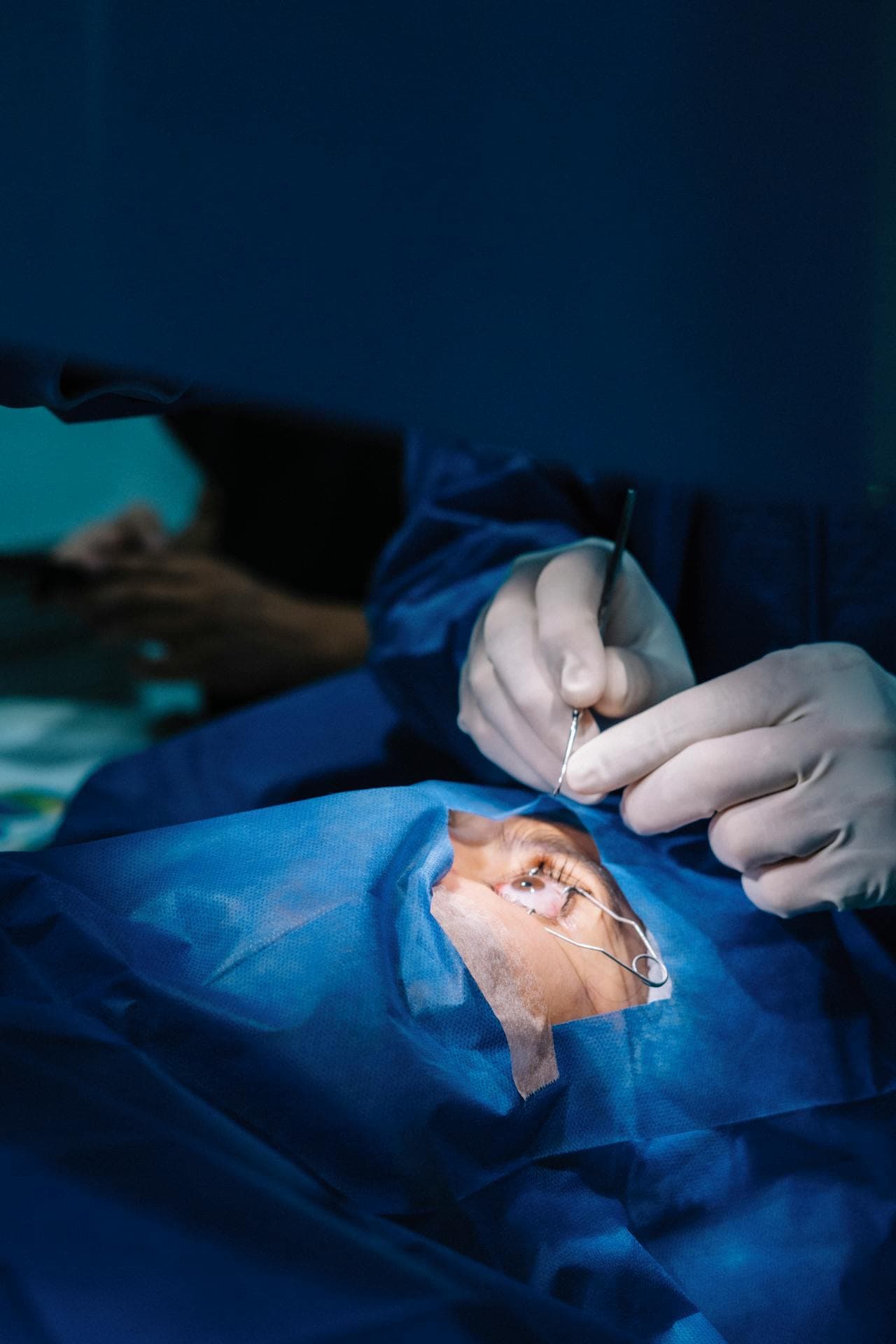 LASIK Eye Surgery